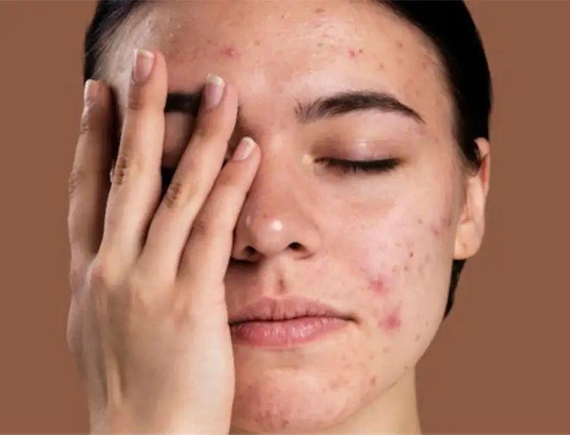 Uneven Skin Tone & Dullness