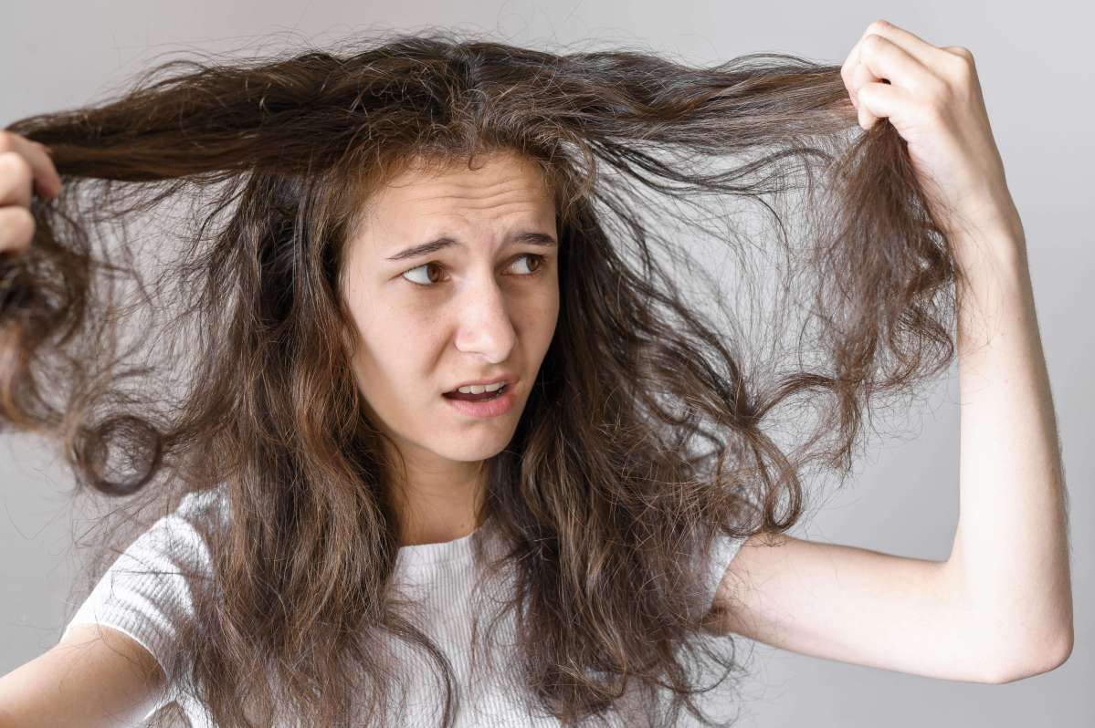 Dry & Dull Hair