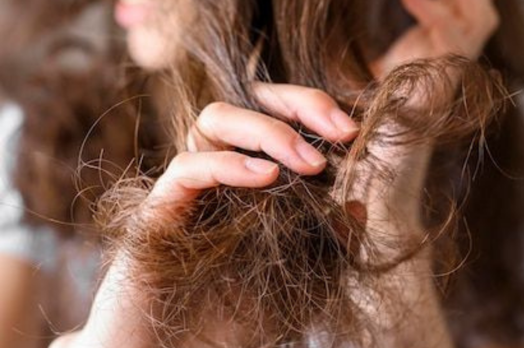 Dry & Damaged Hair