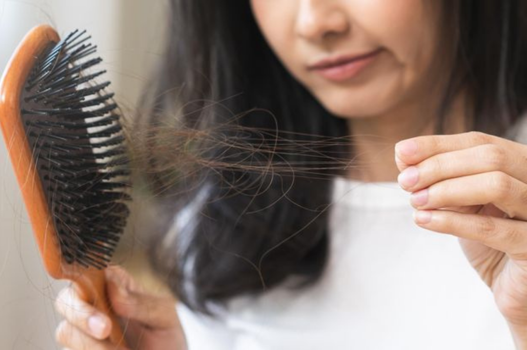 Excessive Hair Fall & Thinning