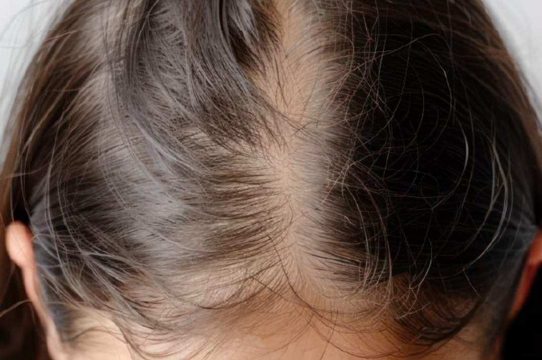 Weak Hair Roots